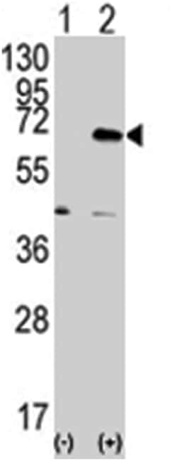 EIF2AK2 Rabbit anti-Human, Mouse, Polyclonal Antibody, Abnova 400 &mu;L | Buy Online | Abnova Corporation | Fisher Scientific