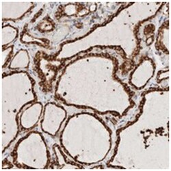 INTS1, Rabbit, Polyclonal Antibody, Abnova 100 &mu;L | Buy Online | Abnova Corporation | Fisher Scientific