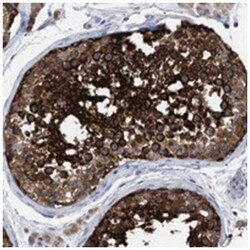 VPS13A Rabbit anti-Human, Polyclonal Antibody, Abnova 100&mu;L; Unlabeled:Antibodies,