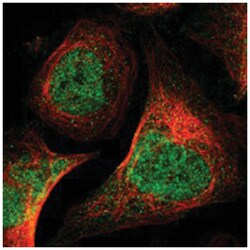 SETD1B Rabbit anti-Human, Polyclonal Antibody, Abnova 100&mu;L; Unlabeled:Antibodies,