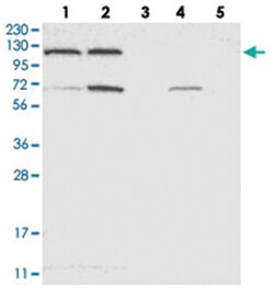 ACLY Rabbit anti-Human, Polyclonal Antibody, Abnova 100 &mu;L | Buy Online | Abnova Corporation | Fisher Scientific