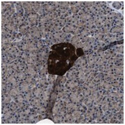 ACLY Rabbit anti-Human, Polyclonal Antibody, Abnova 100 &mu;L | Buy Online | Abnova Corporation | Fisher Scientific