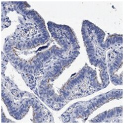 CROCC Rabbit anti-Human, Polyclonal Antibody, Abnova 100&mu;L; Unlabeled:Antibodies,