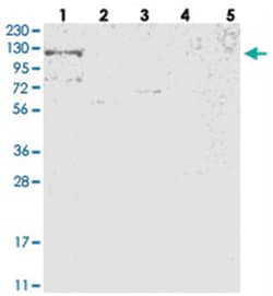 RBM33 Rabbit anti-Human, Mouse, Polyclonal Antibody, Abnova 100 &mu;L | Buy Online | Abnova Corporation | Fisher Scientific