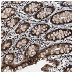 RBM33 Rabbit anti-Human, Mouse, Polyclonal Antibody, Abnova 100 &mu;L | Buy Online | Abnova Corporation | Fisher Scientific