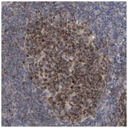 RBM48 Rabbit anti-Human, Polyclonal Antibody, Abnova 100 &mu;L | Buy Online | Abnova Corporation | Fisher Scientific