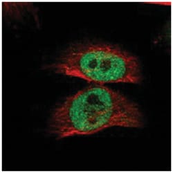 RBM48 Rabbit anti-Human, Polyclonal Antibody, Abnova 100 &mu;L | Buy Online | Abnova Corporation | Fisher Scientific