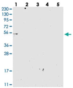 MKS1 Rabbit anti-Human, Polyclonal Antibody, Abnova 100&mu;L; Unlabeled:Antibodies,