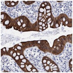 MKS1 Rabbit anti-Human, Polyclonal Antibody, Abnova 100&mu;L; Unlabeled:Antibodies,