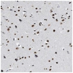 NUP88, Rabbit, Polyclonal Antibody, Abnova 100 &mu;L | Buy Online | Abnova Corporation | Fisher Scientific