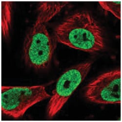 NUP88, Rabbit, Polyclonal Antibody, Abnova 100 &mu;L | Buy Online | Abnova Corporation | Fisher Scientific