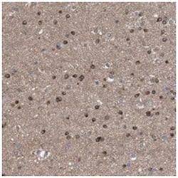 FHOD3 Rabbit anti-Human, Polyclonal Antibody, Abnova 100 &mu;L | Buy Online | Abnova Corporation | Fisher Scientific