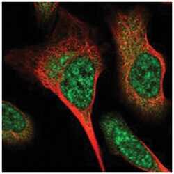FHOD3 Rabbit anti-Human, Polyclonal Antibody, Abnova 100 &mu;L | Buy Online | Abnova Corporation | Fisher Scientific