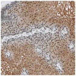 C9orf169 Rabbit anti-Human, Polyclonal Antibody, Abnova 100 &mu;L | Buy Online | Abnova Corporation | Fisher Scientific