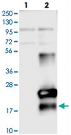 C9orf169 Rabbit anti-Human, Polyclonal Antibody, Abnova 100 &mu;L | Buy Online | Abnova Corporation | Fisher Scientific