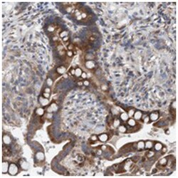 QRICH2, Rabbit, Polyclonal Antibody, Abnova 100 &mu;L | Buy Online | Abnova Corporation | Fisher Scientific