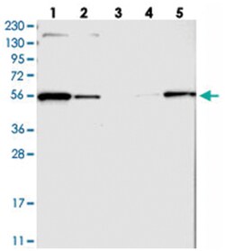 MFSD11, Rabbit, Polyclonal Antibody, Abnova 100&mu;L; Unlabeled:Antibodies,