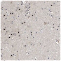 NOL11, Rabbit, Polyclonal Antibody, Abnova 100&mu;L; Unlabeled:Antibodies,