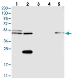 CDR2L, Rabbit, Polyclonal Antibody, Abnova 100 &mu;L | Buy Online | Abnova Corporation | Fisher Scientific