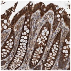 ABCA5, Rabbit, Polyclonal Antibody, Abnova 100 &mu;L | Buy Online | Abnova | Fisher Scientific