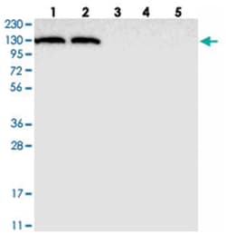 ACLY Rabbit anti-Human, Polyclonal Antibody, Abnova 100&mu;L; Unlabeled:Antibodies,