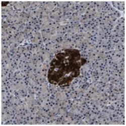 ACLY Rabbit anti-Human, Polyclonal Antibody, Abnova 100&mu;L; Unlabeled:Antibodies,