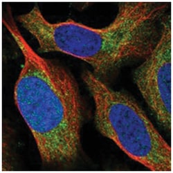 ACLY Rabbit anti-Human, Polyclonal Antibody, Abnova 100&mu;L; Unlabeled:Antibodies,