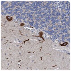 RSAD1 Rabbit anti-Human, Polyclonal Antibody, Abnova 100 &mu;L | Buy Online | Abnova | Fisher Scientific