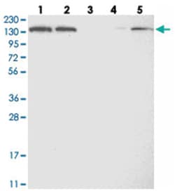 PFAS Rabbit anti-Human, Polyclonal Antibody, Abnova 100 &mu;L | Buy Online | Abnova Corporation | Fisher Scientific