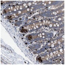 NYAP1, Rabbit, Polyclonal Antibody, Abnova 100&mu;L; Unlabeled:Antibodies,