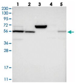 LPCAT1 Rabbit anti-Human, Polyclonal Antibody, Abnova 100 &mu;L | Buy Online | Abnova Corporation | Fisher Scientific