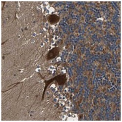 LPCAT1 Rabbit anti-Human, Polyclonal Antibody, Abnova 100 &mu;L | Buy Online | Abnova Corporation | Fisher Scientific