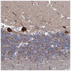 TWISTNB Rabbit anti-Human, Polyclonal Antibody, Abnova 100 &mu;L | Buy Online | Abnova Corporation | Fisher Scientific