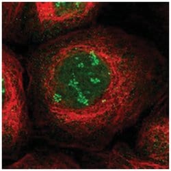 TWISTNB Rabbit anti-Human, Polyclonal Antibody, Abnova 100 &mu;L | Buy Online | Abnova Corporation | Fisher Scientific