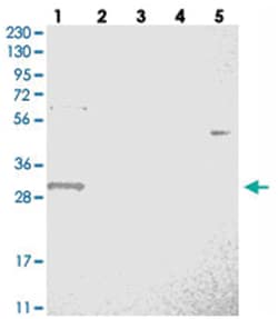 WBSCR27, Rabbit, Polyclonal Antibody, Abnova 100 &mu;L | Buy Online | Abnova Corporation | Fisher Scientific