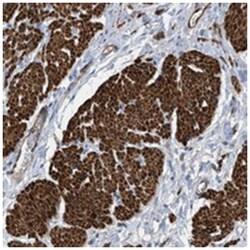 GARNL3 Rabbit anti-Human, Polyclonal Antibody, Abnova 100&mu;L; Unlabeled:Antibodies,