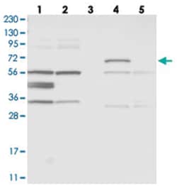 ZNF800, Rabbit, Polyclonal Antibody, Abnova 100&mu;L; Unlabeled:Antibodies,