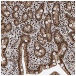 ZNF800, Rabbit, Polyclonal Antibody, Abnova 100&mu;L; Unlabeled:Antibodies,