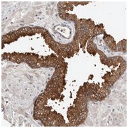 MSL1 Rabbit anti-Human, Polyclonal Antibody, Abnova 100&mu;L; Unlabeled:Antibodies,