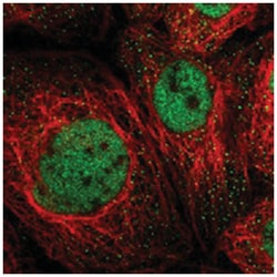 MSL1 Rabbit anti-Human, Polyclonal Antibody, Abnova 100&mu;L; Unlabeled:Antibodies,