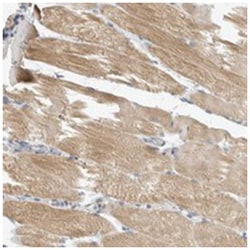 NEFM Rabbit anti-Human, Polyclonal Antibody, Abnova 100 &mu;L | Buy Online | Abnova Corporation | Fisher Scientific