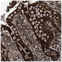 ATAD4, Rabbit, Polyclonal Antibody, Abnova 100 &mu;L | Buy Online | Abnova Corporation | Fisher Scientific