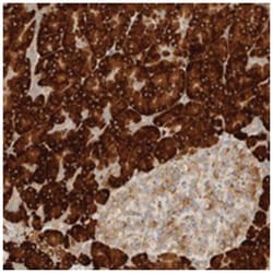 CCDC144A, Rabbit, Polyclonal Antibody, Abnova 100 &mu;L | Buy Online | Abnova Corporation | Fisher Scientific