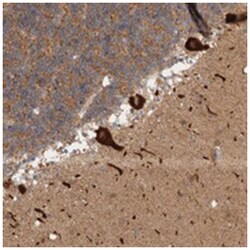 C17orf53 Rabbit anti-Human, Polyclonal Antibody, Abnova 100 &mu;L | Buy Online | Abnova Corporation | Fisher Scientific