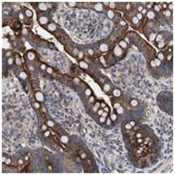 TTC19, Rabbit, Polyclonal Antibody, Abnova 100 &mu;L | Buy Online | Abnova Corporation | Fisher Scientific