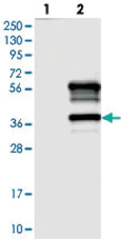 TTC19, Rabbit, Polyclonal Antibody, Abnova 100 &mu;L | Buy Online | Abnova Corporation | Fisher Scientific