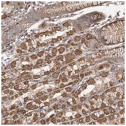 C9orf128 Rabbit anti-Human, Polyclonal Antibody, Abnova 100 &mu;L | Buy Online | Abnova Corporation | Fisher Scientific