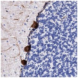 FAM100B, Rabbit, Polyclonal Antibody, Abnova 100&mu;L; Unlabeled:Antibodies,