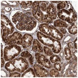 MRPL12, Rabbit, Polyclonal Antibody, Abnova 100 &mu;L | Buy Online | Abnova Corporation | Fisher Scientific