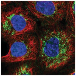 MRPL12, Rabbit, Polyclonal Antibody, Abnova 100 &mu;L | Buy Online | Abnova Corporation | Fisher Scientific